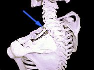 左第1肋椎関節
